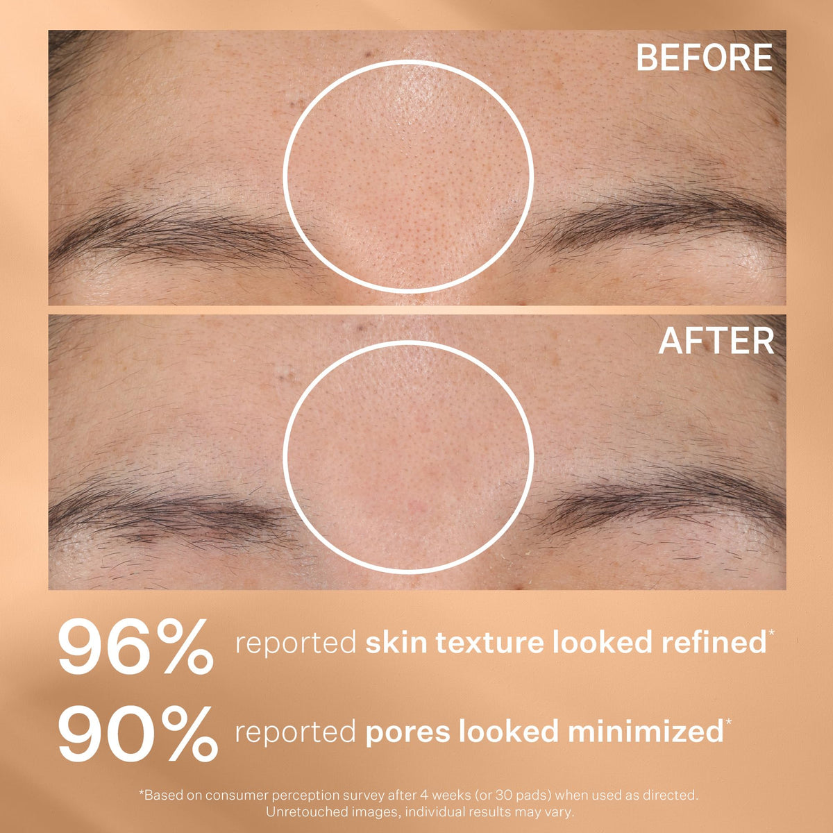 StriVectin before and after skin texture comparison showing smoother skin