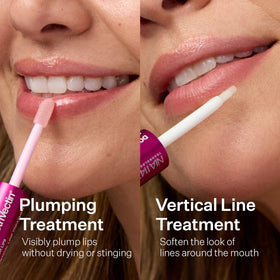 StriVectin DoubleFix lips before and after comparison showing visible plumping benefit