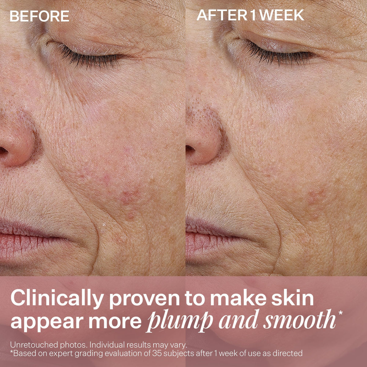 StriVectin label zoom on ingredient panel highlighting peptides and targeted benefits