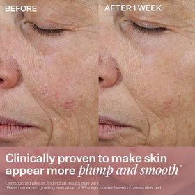 StriVectin label zoom on ingredient panel highlighting peptides and targeted benefits