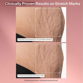 StriVectin used on neck and jawline to help firm skin