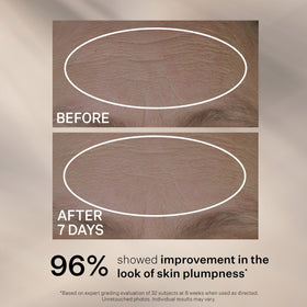 StriVectin serum being applied to hand demonstrating fast absorption and smooth finish