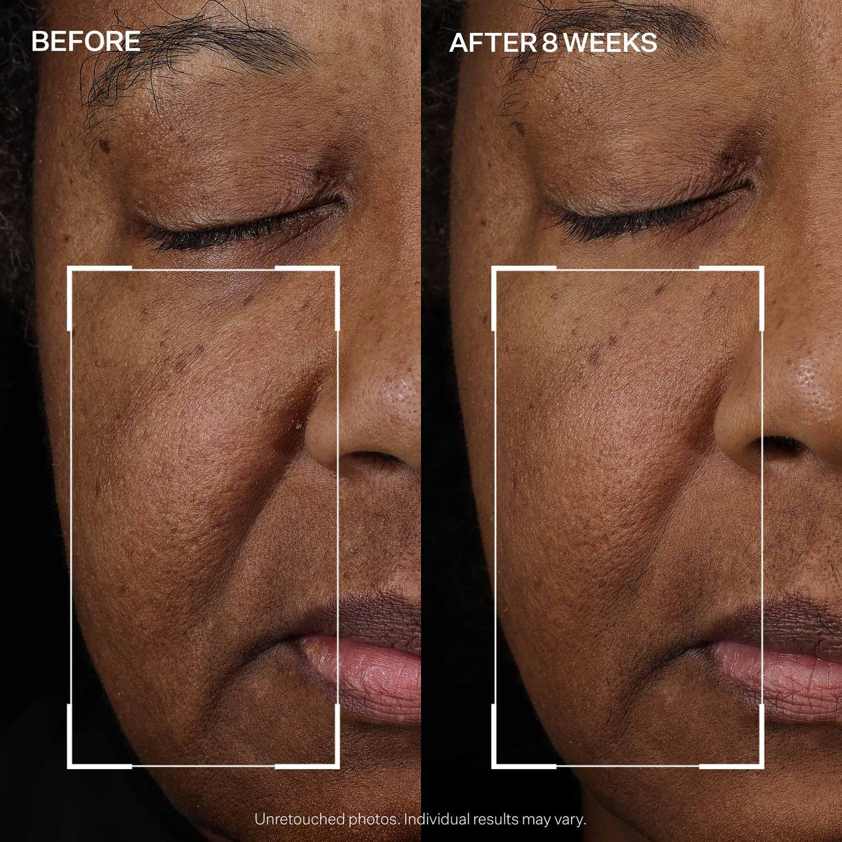 StriVectin pump dispensing serum illustrating precise, hygienic application benefit