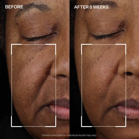 StriVectin pump dispensing serum illustrating precise, hygienic application benefit
