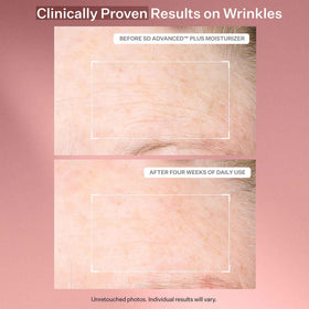 StriVectin applied to thighs targeting the look of stretchmarks