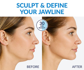 stylia diagram of dual-zone design illustrating lift and coverage across jawline