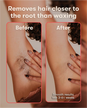SUGARDOH applied to bikini area illustrating gentle removal benefit
