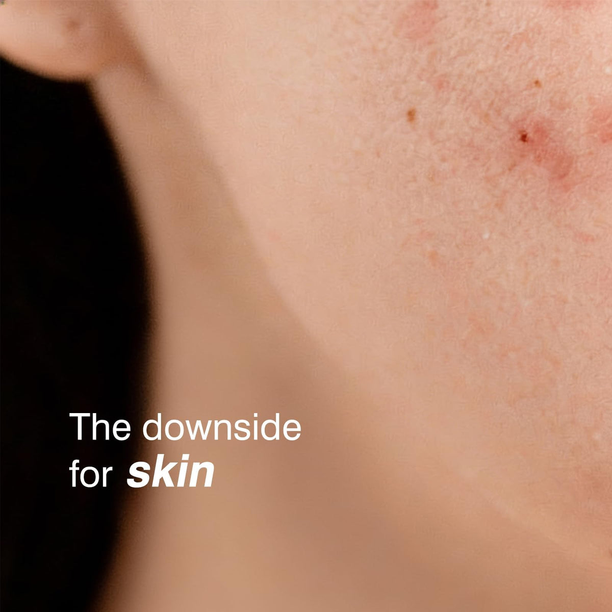 SUMAX relief serum visual of ceramide molecules illustrating barrier-supporting benefit