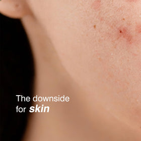 SUMAX relief serum visual of ceramide molecules illustrating barrier-supporting benefit