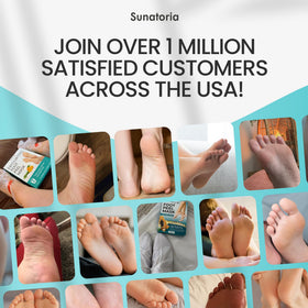 SUNATORIA after-treatment smooth heels illustrating softer results