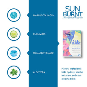 Sunburnt mask applied on model cooling and soothing sun-exposed skin