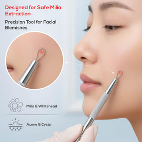 Suvorna loop extractor detail highlighting firm loop for controlled blackhead removal