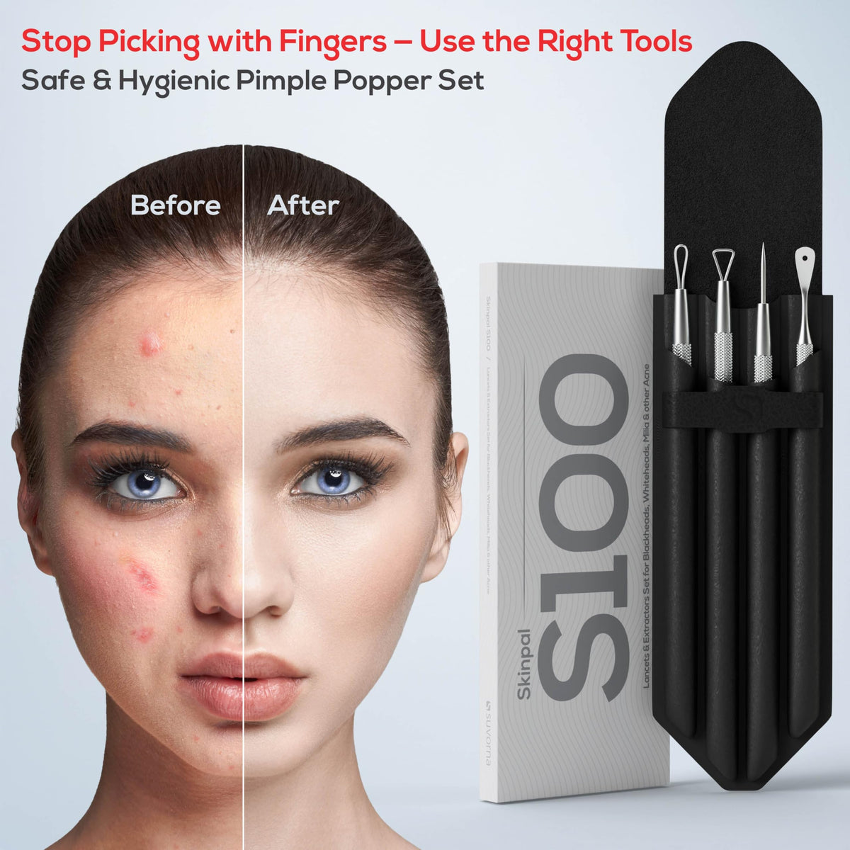 Suvorna tool being used on forehead illustrating accurate home extractions when careful