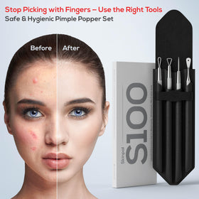 Suvorna tool being used on forehead illustrating accurate home extractions when careful