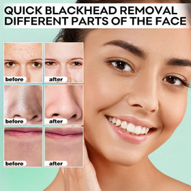 SYABO peel-off action being removed to reveal cleaner pores and clearer skin