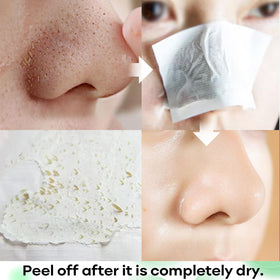 SYABO strip applied to nose demonstrating targeted blackhead extraction benefit