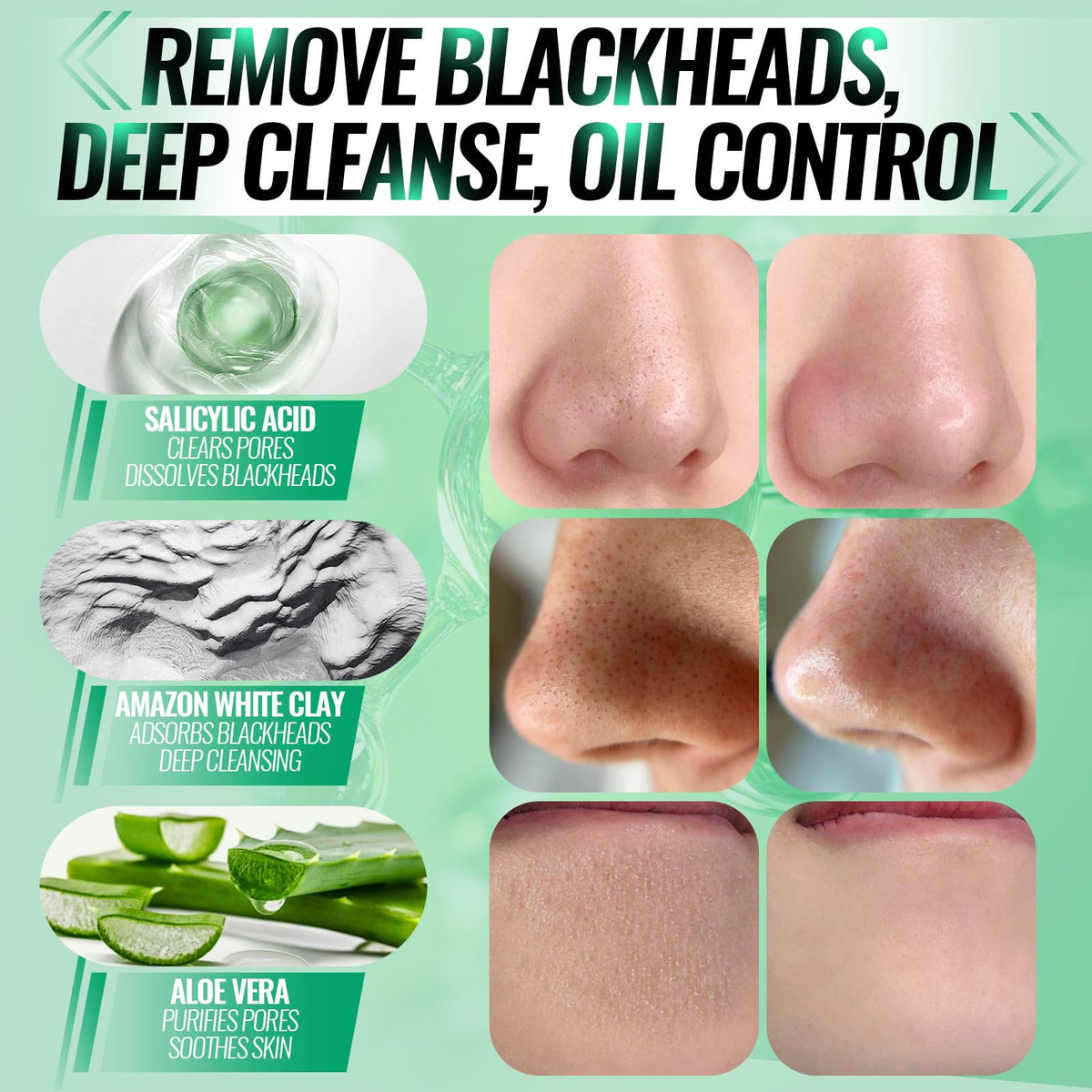 SYABO removed strip with lifted blackheads showing clearer pore benefit