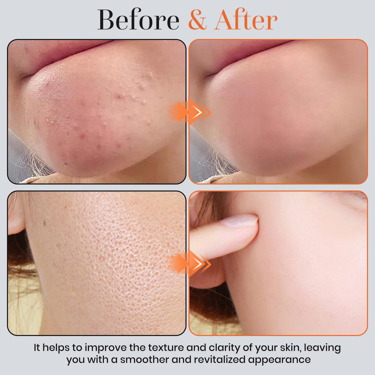 T.Chilyn application on face demonstrating mild enzyme action benefit