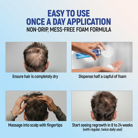 TARO being applied to scalp targeting thinning areas for convenient twice daily use