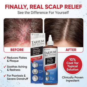 Tarsum gel texture closeup highlighting easy spread and soothing feel
