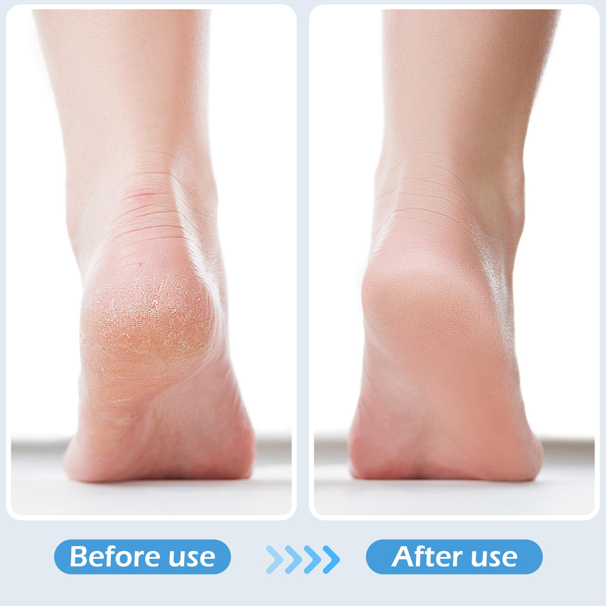 TaShow foot brush in shower being used to scrub and soften skin for quick care
