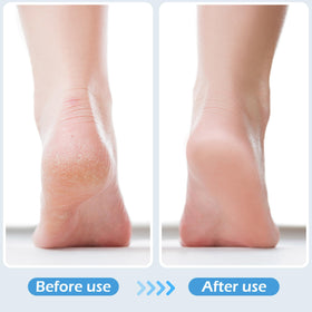 TaShow foot brush in shower being used to scrub and soften skin for quick care