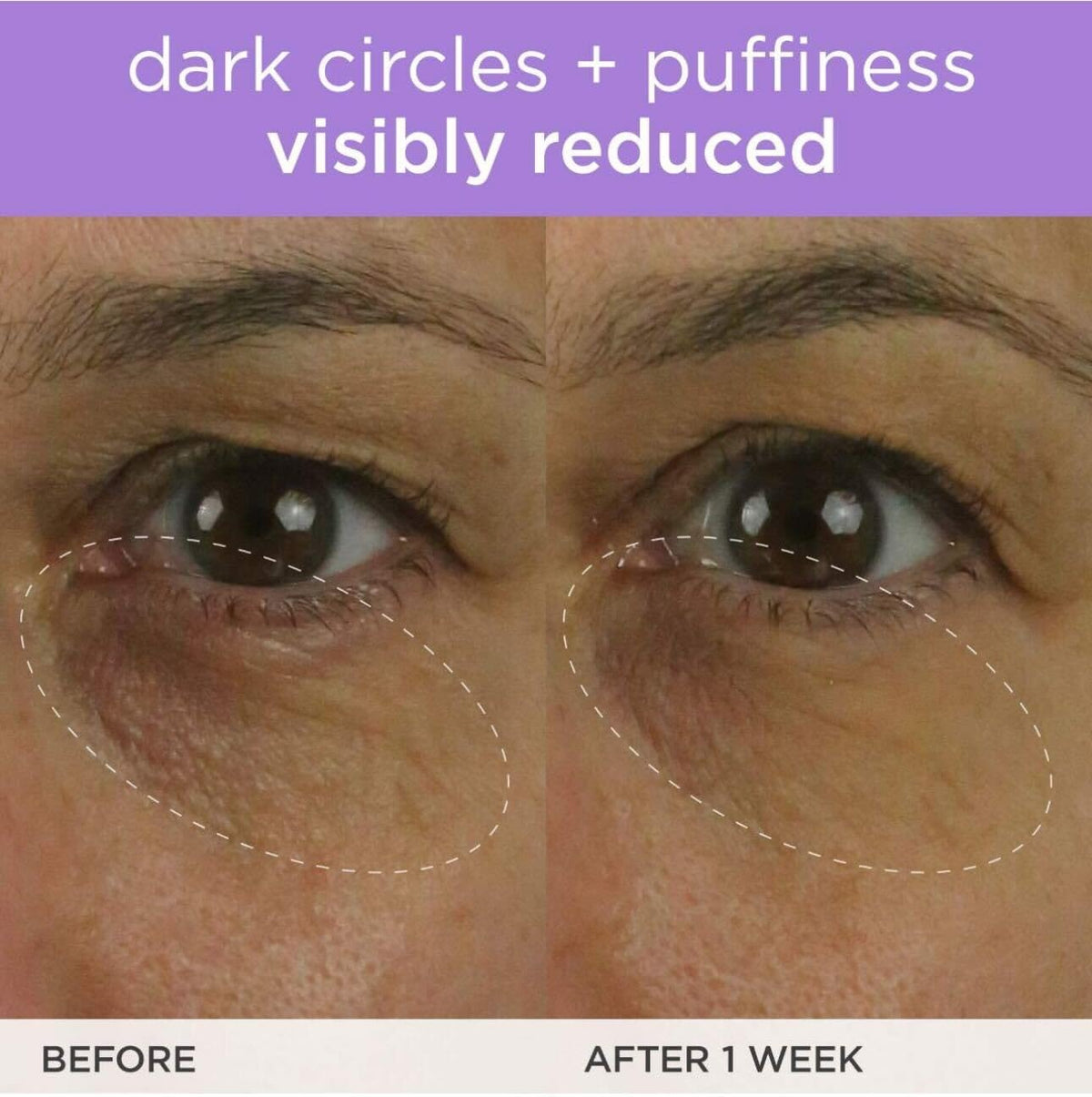 TATCHA applying cream under eye demonstrating gentle pat technique benefit