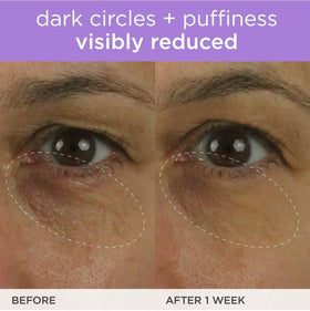 TATCHA applying cream under eye demonstrating gentle pat technique benefit