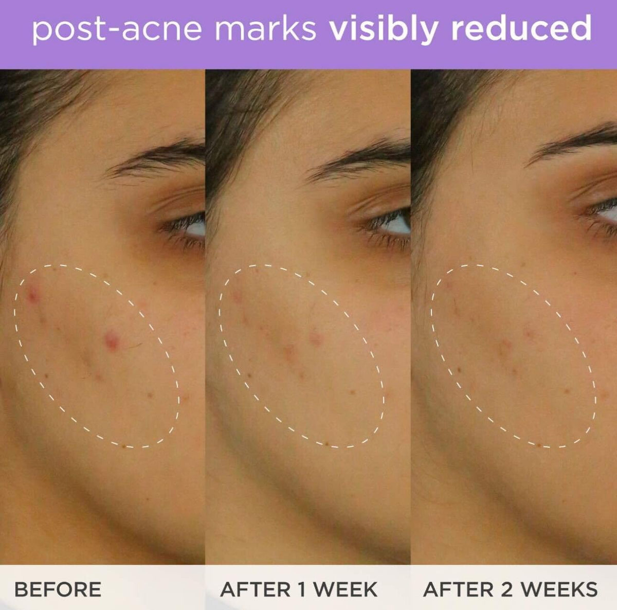 TATCHA ingredient vial with vitamin C and ferulic accentuating antioxidant potency
