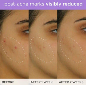 TATCHA ingredient vial with vitamin C and ferulic accentuating antioxidant potency
