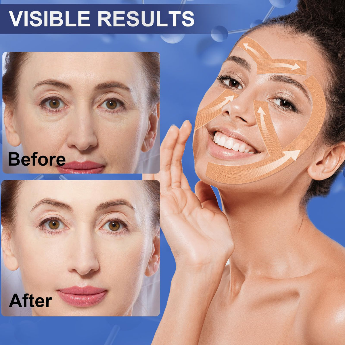 TEAWOO tape applied to forehead demonstrating wrinkle lift