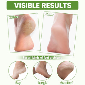 TEAWOO foot mask in use while relaxing, demonstrating mess-free application