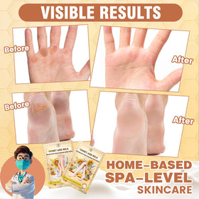 TEAWOO foot mask being worn during a 15-minute home treatment for convenience