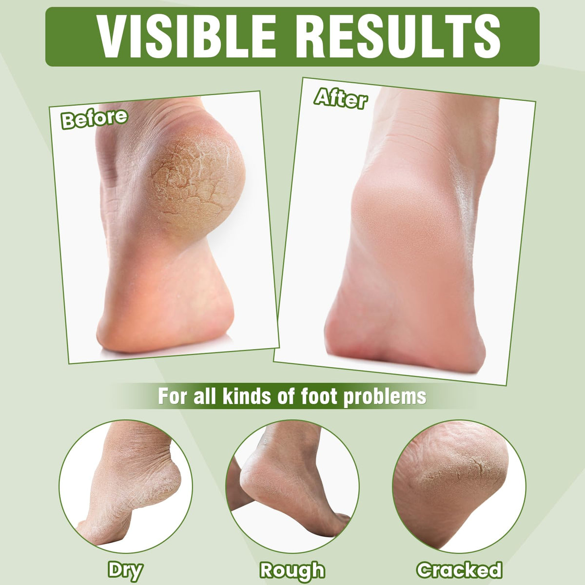 TEAWOO foot mask worn on foot demonstrating comfortable, mess-free use