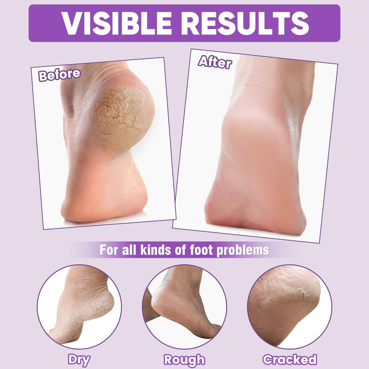 TEAWOO open foot mask pair revealing serum for deep hydration benefit