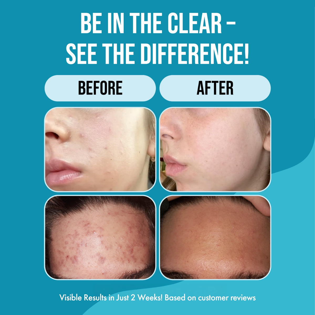 Teenology in-shower use rinsing clean to reduce pore-clogging residue