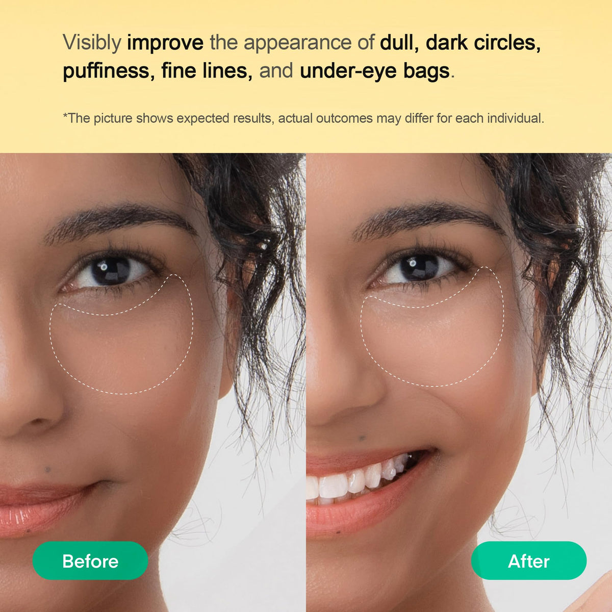 Terez & Honor patch applied under eye demonstrating de-puffing and quick refresh