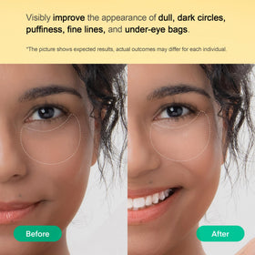 Terez & Honor patch applied under eye demonstrating de-puffing and quick refresh