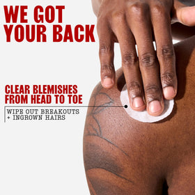 Thayers focused texture before-and-after showing improved skin clarity benefit