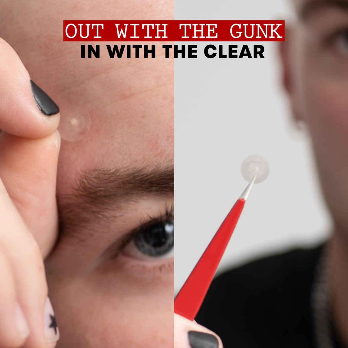 THAYERS patch applied to cheek reducing visibility and protecting blemish