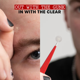 THAYERS patch applied to cheek reducing visibility and protecting blemish