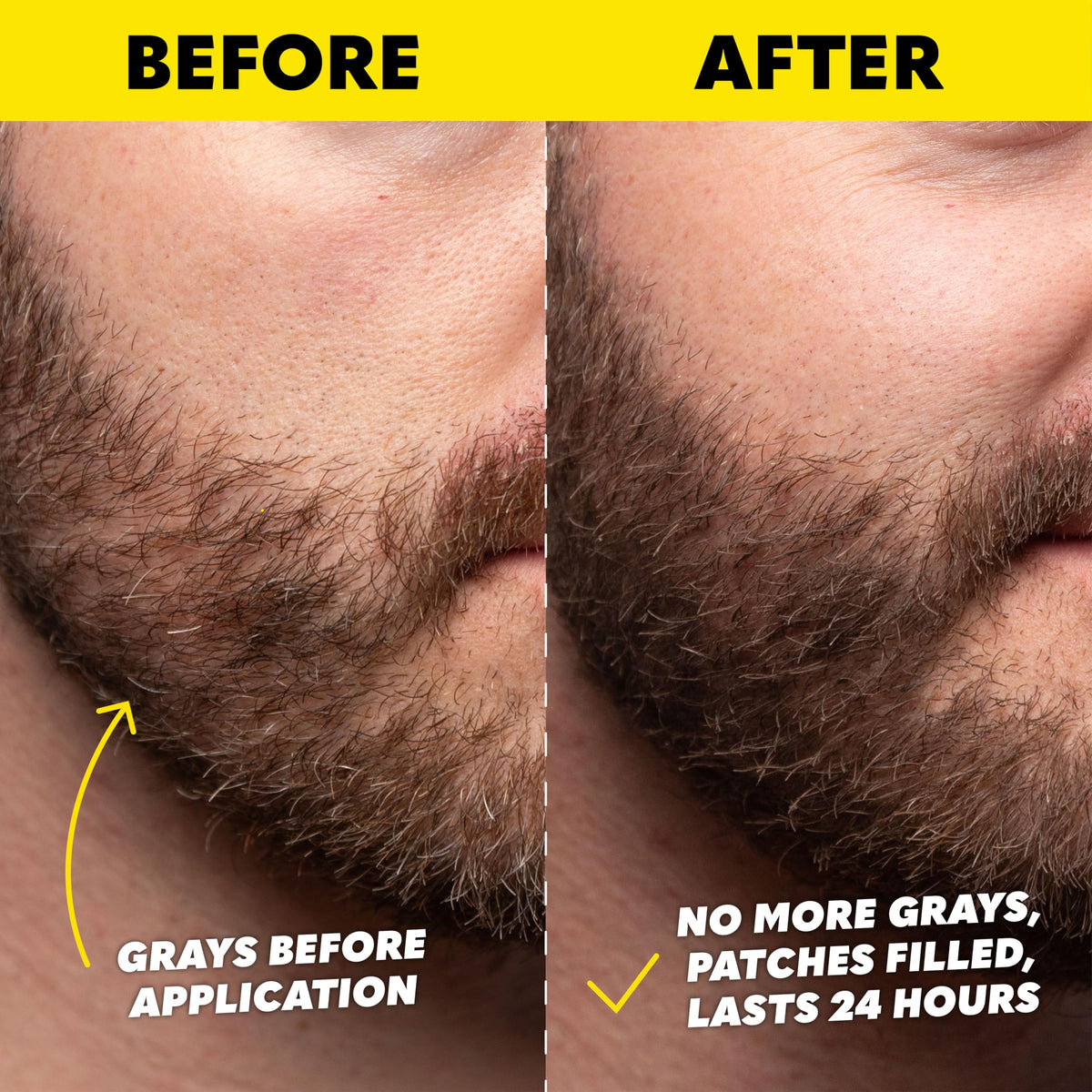 The Beard Club before-and-after beard comparison illustrating fuller, defined appearance