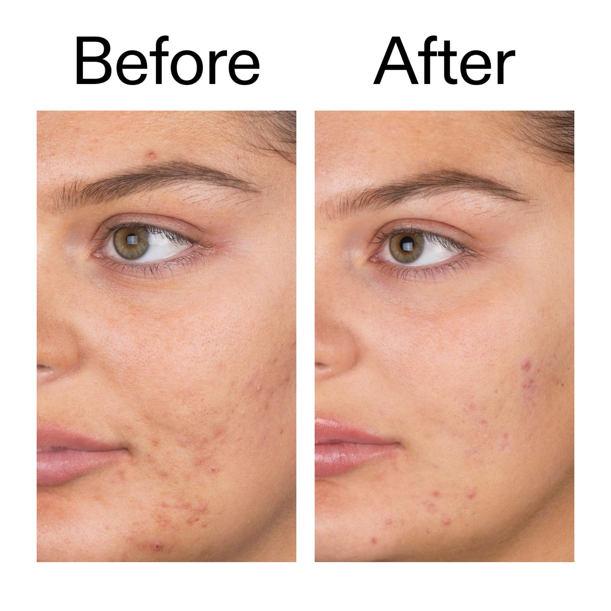 the inkey list before and after split highlighting improved clarity benefit