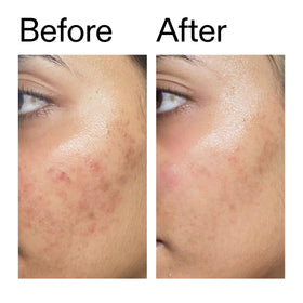 The INKEY List serum styled on a bathroom shelf, showing everyday routine convenience benefit