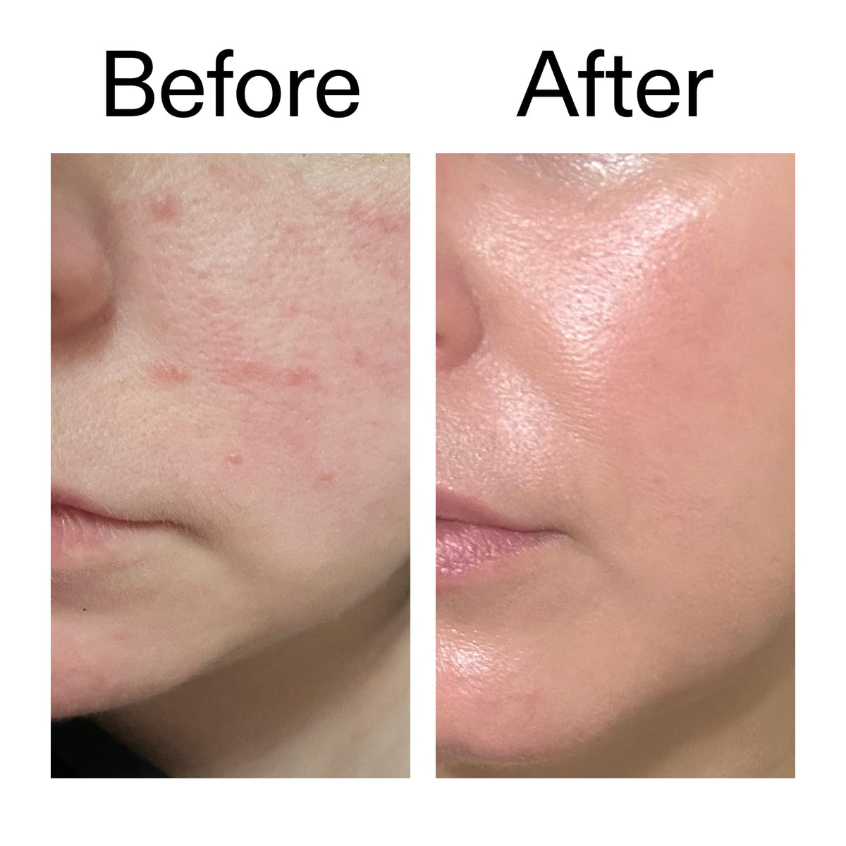 Subtle before and after skin glow comparison with The INKEY List serum