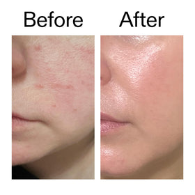Subtle before and after skin glow comparison with The INKEY List serum