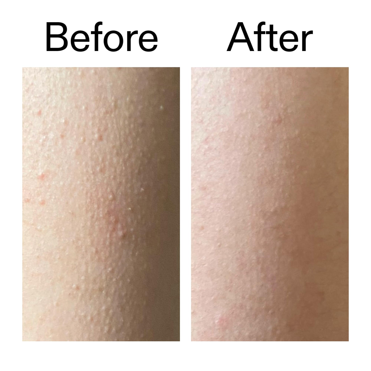 Ingredients label of The INKEY List stick highlighting active acids benefit