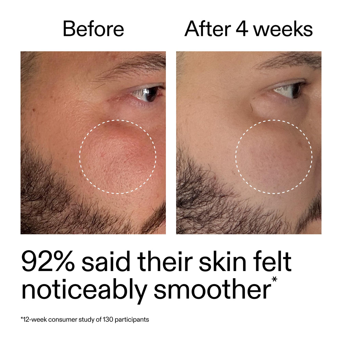 The INKEY List bottle beside moisturizer on sink, showing layered skincare benefit