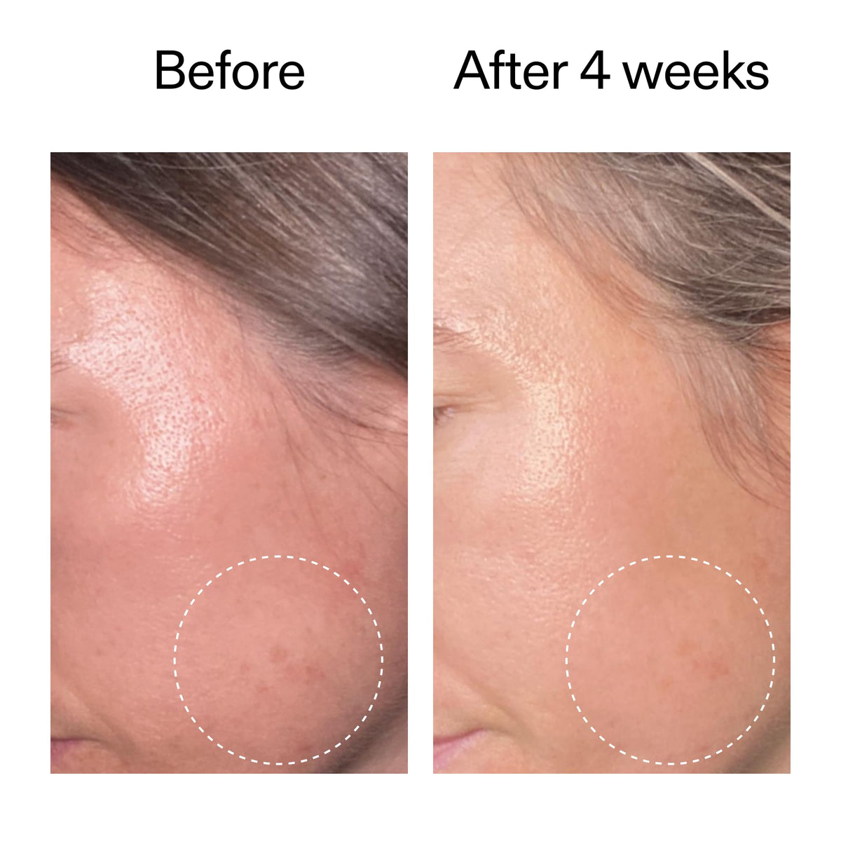 The INKEY List nighttime application on face portraying easy evening use