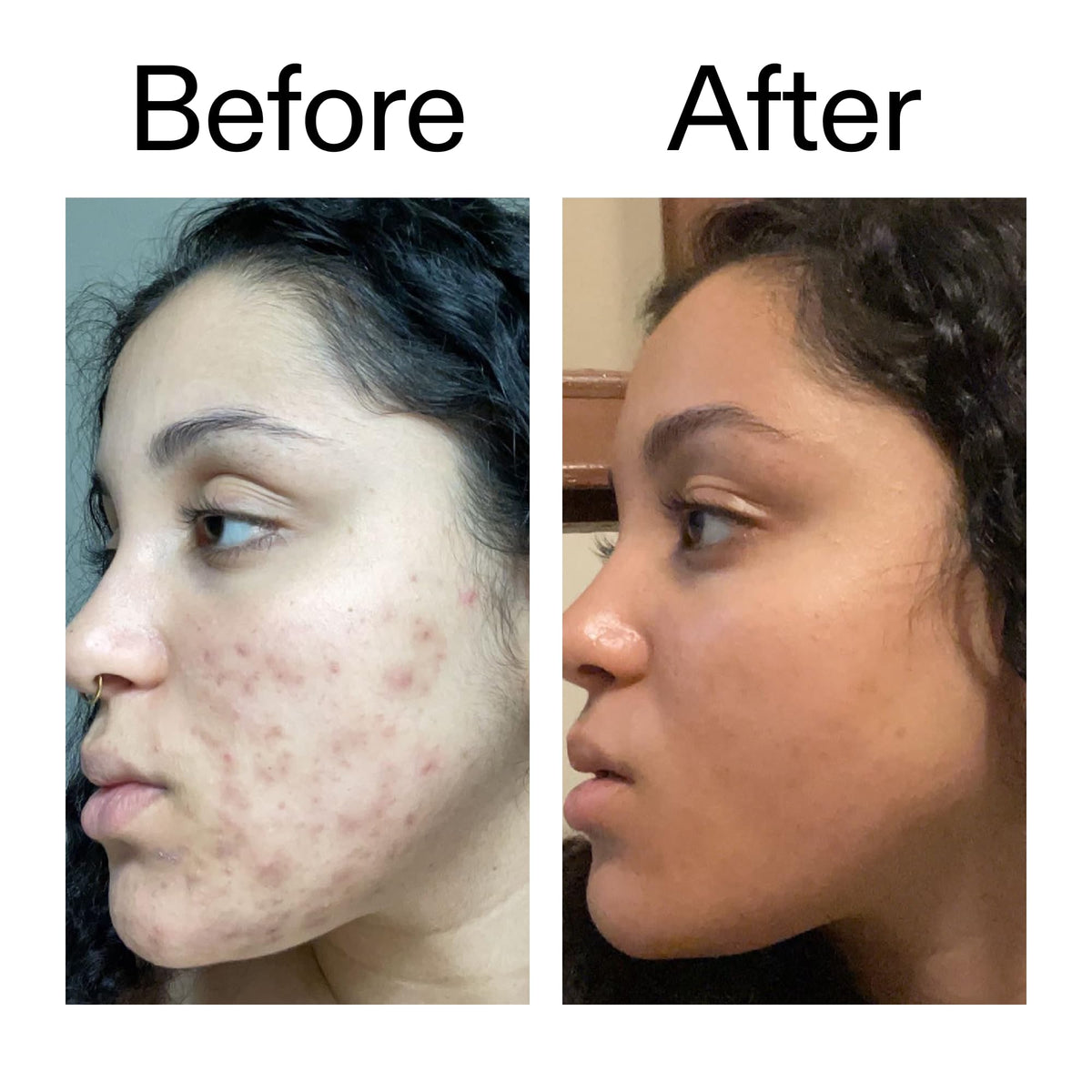 The INKEY List swatch before and after showing improved even skin tone